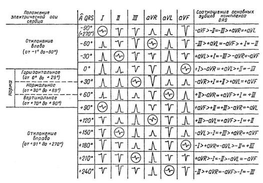 примерная форма комплексов qrs в отведениях от конечностей при различных положениях электрической оси сердца (кружком отмечены нулевые отведения)