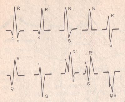 варианты комплекса qrs