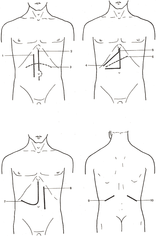 http://vmede.org/sait/content/anatomija_topograficheskaja_i_operativnaja_hirurgija_atlas_oper_voilenko/img/684.gif
