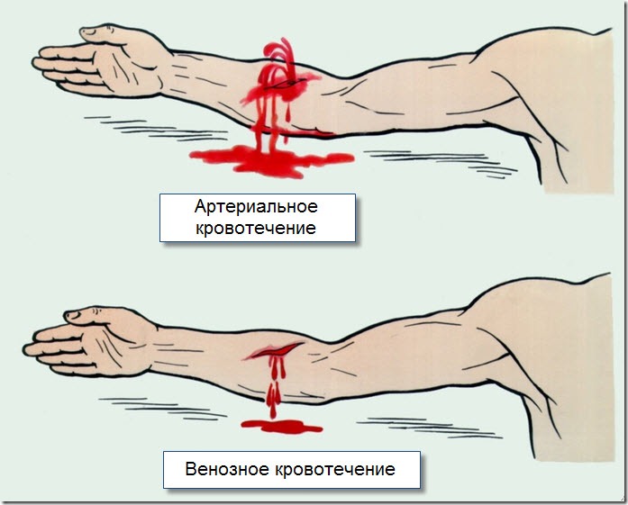 http://nedomedic.ru/wp-content/uploads/2012/08/%d0%9a%d1%80%d0%be%d0%b2%d0%be%d1%82%d0%b5%d1%87%d0%b5%d0%bd%d0%b8%d0%b5.jpg