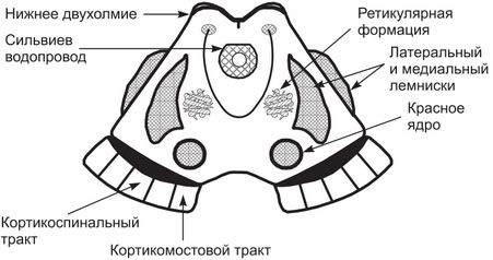 http://www.grandars.ru/images/1/review/id/5580/0eb47101f8.jpg