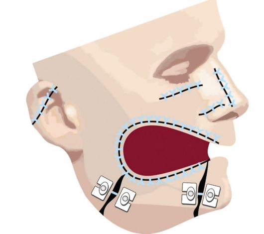 http://vmede.org/sait/content/anatomija_topograficheskaja_kagin_4emezov_2009/12_files/mb4_034.jpeg