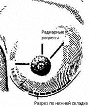 http://bsmu-all.narod.ru/mats/topka/topka_otvety.files/image033.jpg