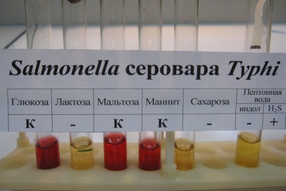 http://microbiologygpma.narod.ru/za4et/sreda/6.2gissas.typhi.jpg