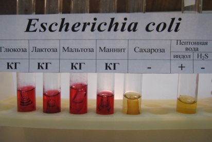 http://microbiologygpma.narod.ru/za4et/sreda/e.coli.jpg