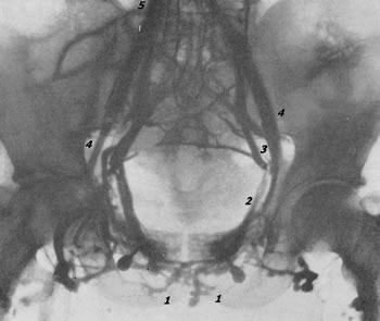 http://uroweb.ru/catalog/med_lib/rg_ur/img/077.jpg