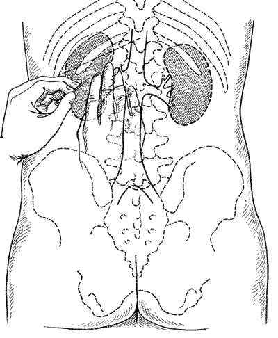 http://uroweb.ru/catalog/med_lib/rg_ur/img/067.gif