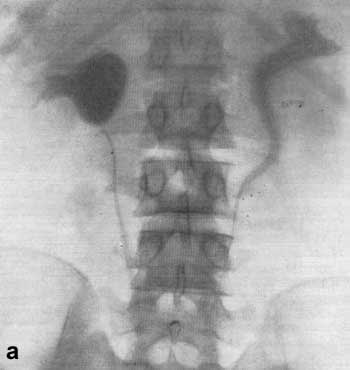 http://uroweb.ru/catalog/med_lib/rg_ur/img/140a.jpg