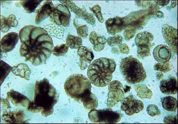 http://kozmopolitaydinlar.files.wordpress.com/2011/03/foraminifera_bearbeitet-1_1280x890.jpg?w=594&h=413
