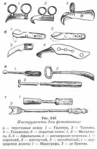 Инструменты в акушерстве в картинках с названиями