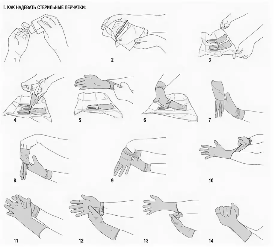 Алгоритм стерильных перчаток. Схема одевания стерильных перчаток. Надевание и снятие стерильных перчаток алгоритм. Одевание стерильных перчаток алгоритм. Снятие стерильных перчаток алгоритм.