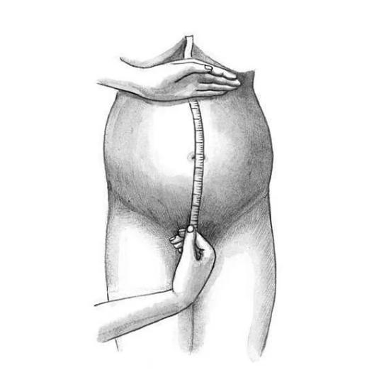 Измерение окружности живота беременной. Измерение ВДМ алгоритм. Высота стояния дна матки алгоритм. Измерение ВДМ беременной. Измерение ВДМ И окружности живота.