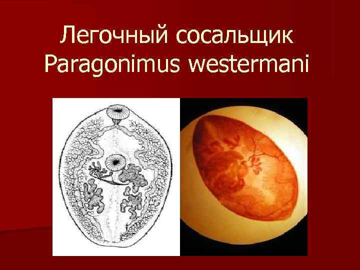 Цикл развития легочного сосальщика. Paragonimus westermani яйцо. Парагонимоз возбудитель. Paragonimus westermani цикл. Легочный сосальщик (Paragonimus westermani).