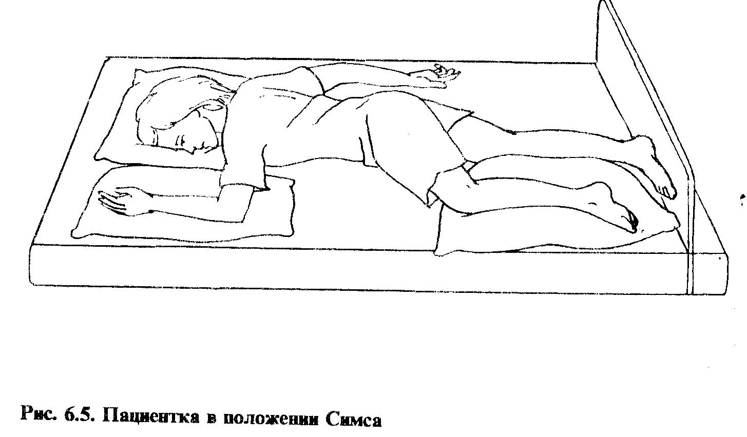 положение пациента в кровати перенесшего операцию на позвоночнике