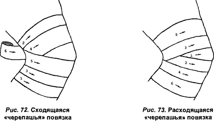 http://zoozel.ru/gallery/images/1871647_cherepashya-povyazka-na-kolennyi-sustav.jpg