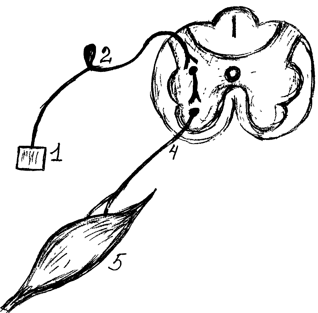 Изобразить схему рефлекторной дуги соматического рефлекса