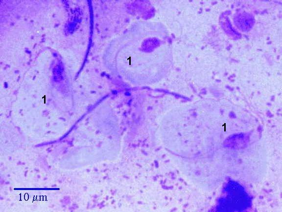 Трихомонады в мазке у женщин фото под микроскопом