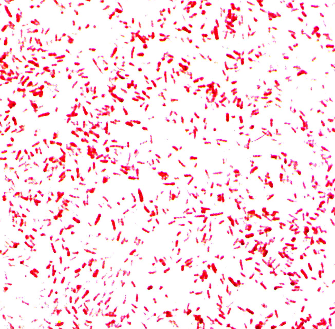 Escherichia coli в сперме у мужчин фото 76