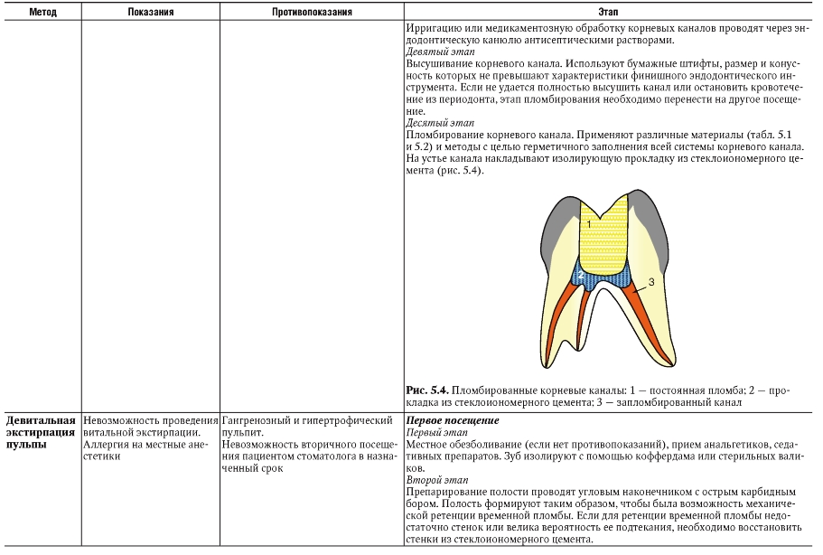 Схема лечения пульпита
