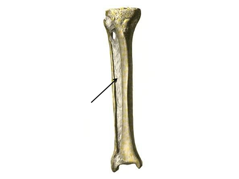 Кости голени соединения. Межберцовый сустав и синдесмоз. Синдесмоз голени анатомия. Малоберцовая кость соединения. Межкостная мембрана голени анатомия.