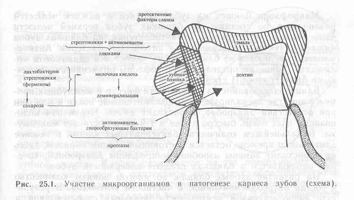 Схема формирования зубной бляшки