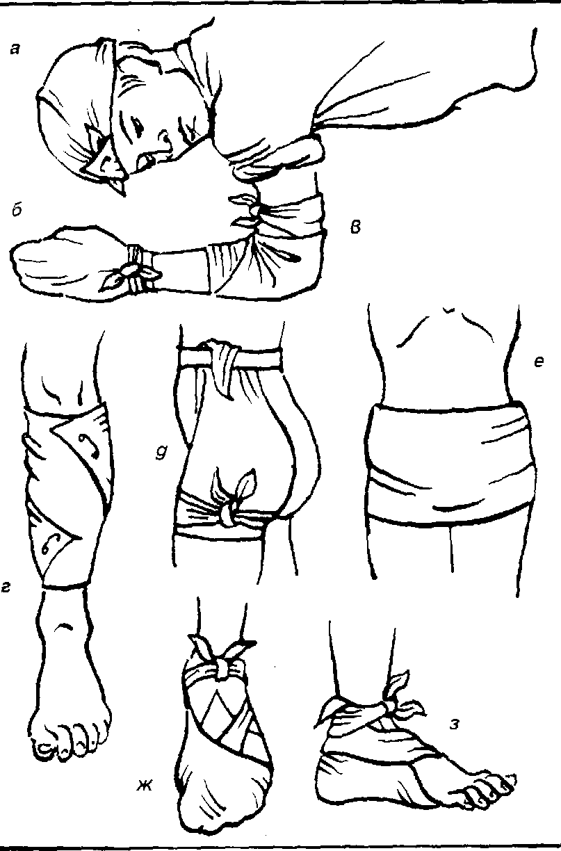 Перевязка косынка. Повязка на бедро. Косыночные повязки. Косыночная повязка на бедро. Косыночная повязка на ягодицы.