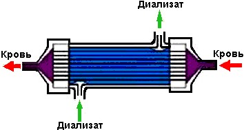 Принцип работы аппарата искусственная почка рисунок