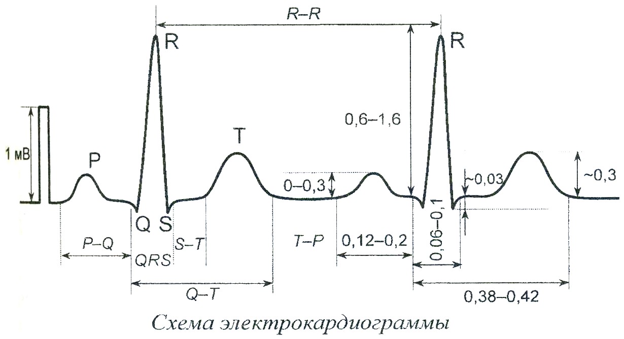 Норма экг рисунок