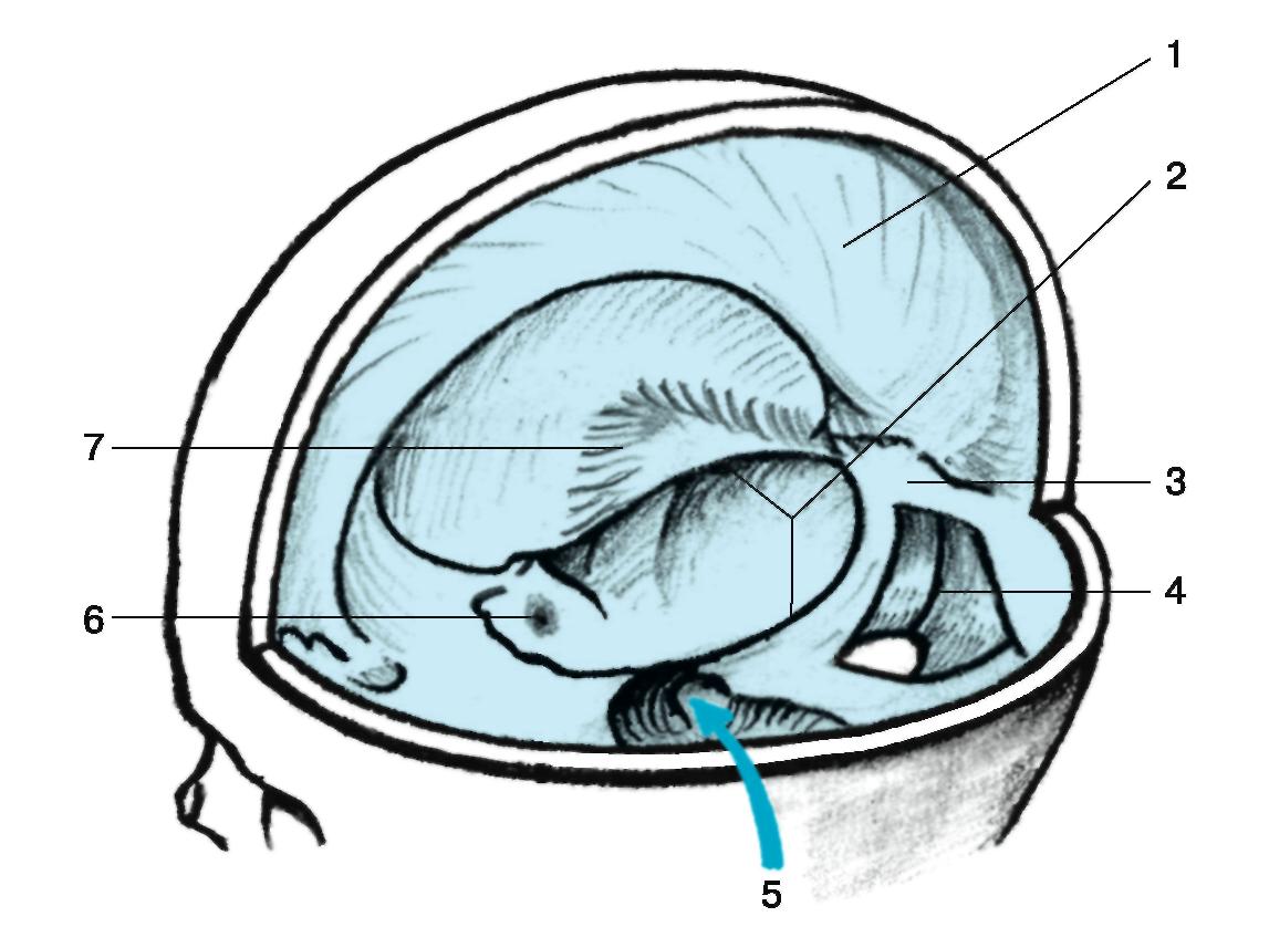 Каудоталамическая вырезка. Намет мозжечка анатомия. Серп мозжечка анатомия. Серп большого мозга и намет мозжечка. Серповидный отросток головного мозга.