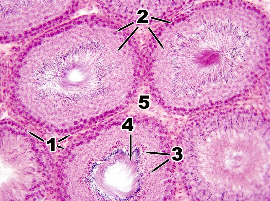 Придаток семенника рисунок гистология