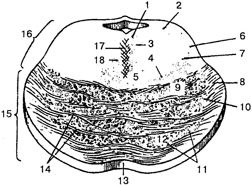 Поперечный срез моста головного мозга схема