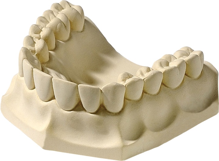 Изготовление гипсовой модели. Гипсовые модели челюстей. Гипсовая модель. Модель зубов из гипса. Гипсовая челюсть.