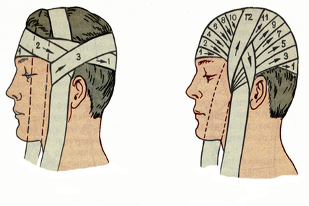 Травмы в области головы