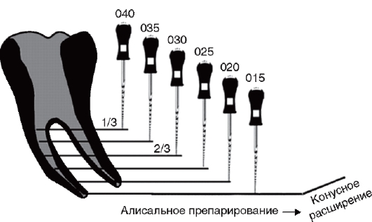 Степ бэк схема