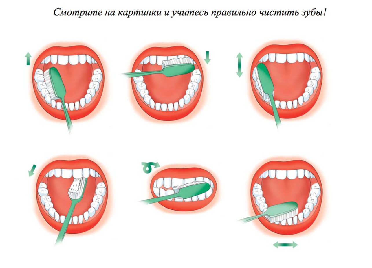 Этапы гигиены полости рта. Схема правильной чистки зубов. Правильная методика чистки зубов зубной щёткой. Схема как правильно чистить зубы. Как правильно чистить зубы картинки для детей.