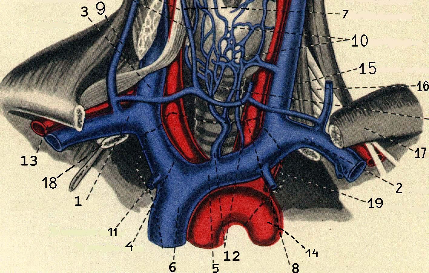 Подключичный тромбоз. Сонная артерия и яремная Вена. Подключичная Вена топография. Внутренняя яремная Вена топография. Правая подключичная Вена.