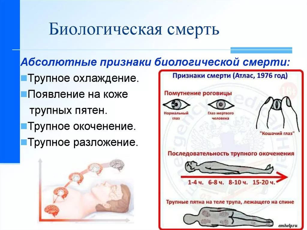 Терминальные состояния картинки