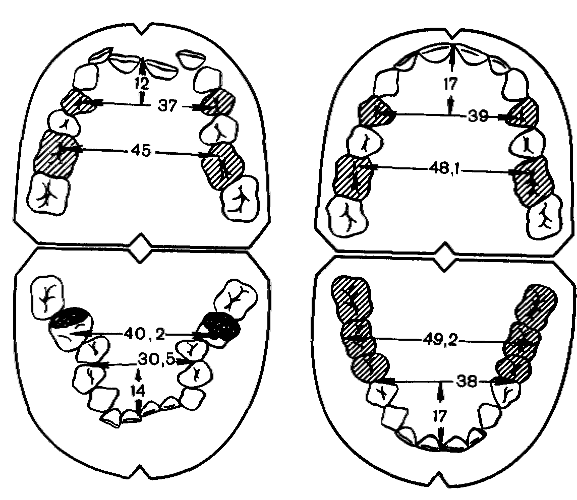 Периоды роста челюстей. Размеры зубных рядов. Пружина Коффина. Схема формирования зубных рядов. Зубной ряд схема.