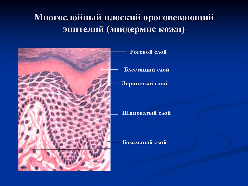 Многослойный ороговевающий эпителий. Многослойный плоский ороговевающий эпителий гистология рисунок. Многослойный плоский эпителий кожи. Многослойный плоский ороговевающий эпителий слои.