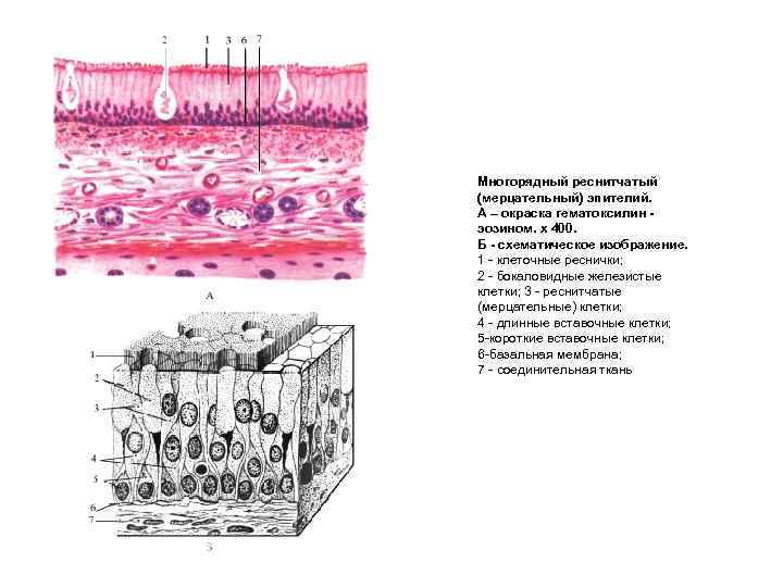 Клетки эпителия кишечника рисунок