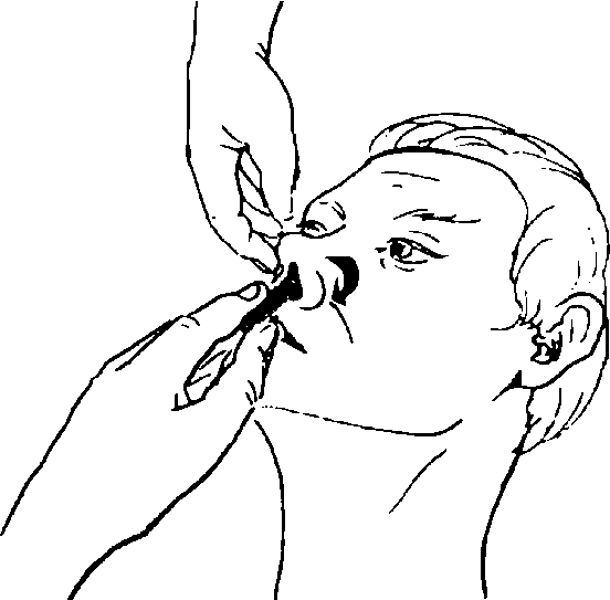 Обработка рта тяжелобольному