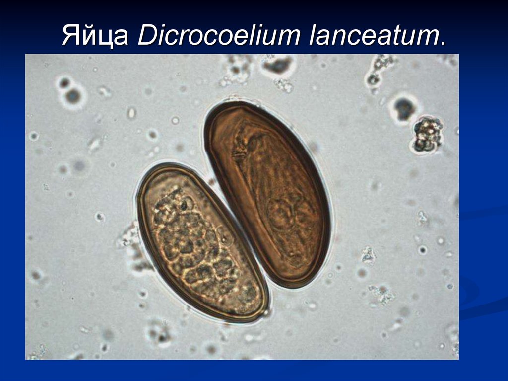 Яйца сосальщиков. Яйцо Ленцетовидного сосальщика препарат. Яйца ланцетовидного сосальщика. Яйца ланцетовидной двуустки строение. Яйца дикроцелий под микроскопом.