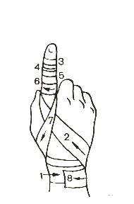 Перевязка пальца на руке бинтом схема
