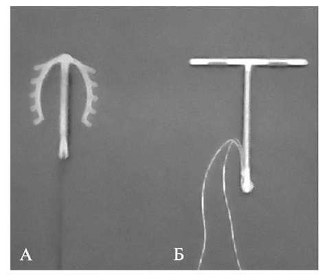 Спираль внутриматочная т образная фото