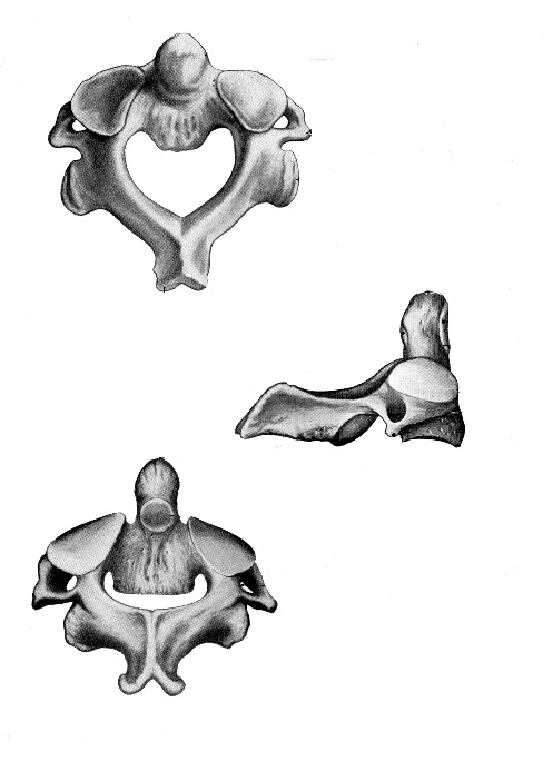 Второй шейный позвонок рисунок
