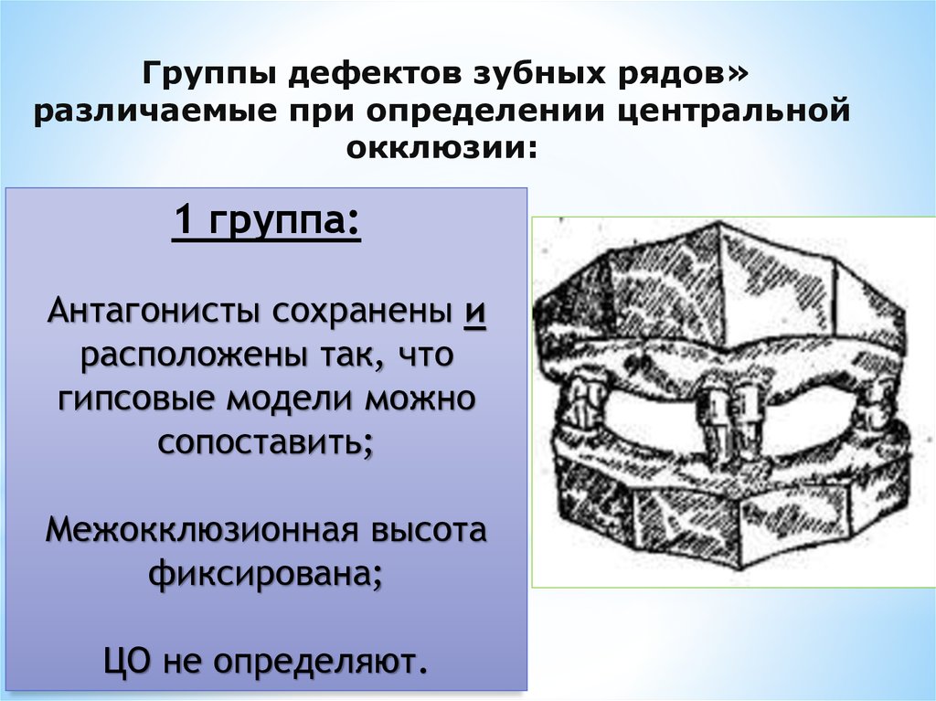 Дефекты зубных рядов. Межокклюзионная высота. Межокклюзионная промежуток. Межаклюзонный проможутк. Определение центральной окклюзии презентация.